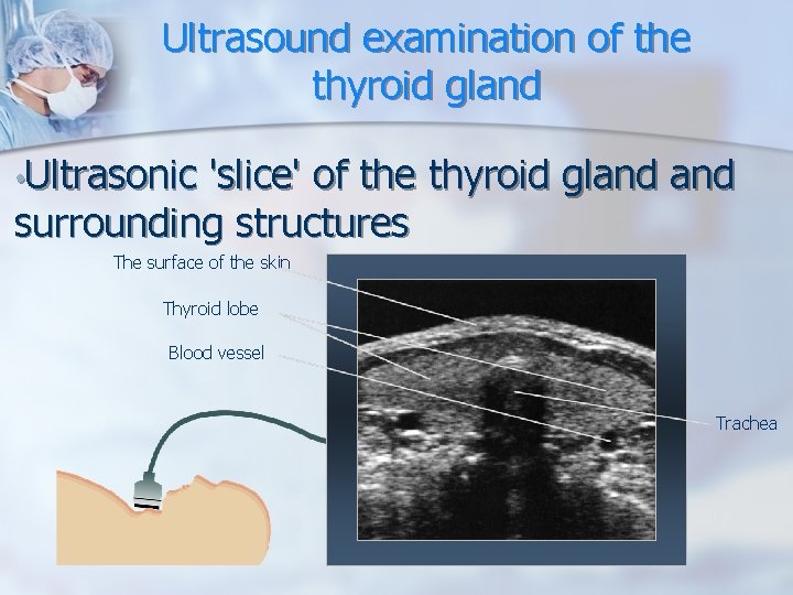Ultrasound examination of the thyroid gland • Ultrasonic 'slice' of the thyroid gland surrounding Ultrasound examination of the thyroid gland • Ultrasonic 'slice' of the thyroid gland surrounding
