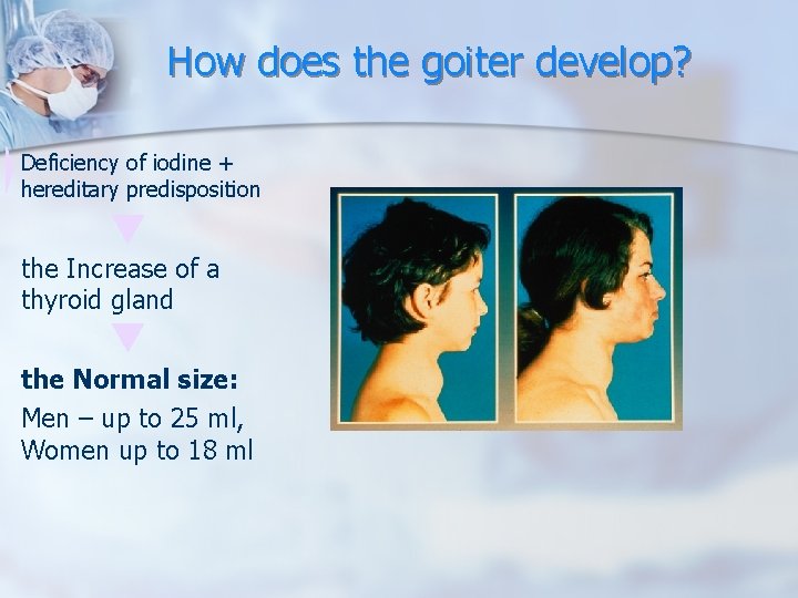 How does the goiter develop? Deficiency of iodine + hereditary predisposition the Increase of How does the goiter develop? Deficiency of iodine + hereditary predisposition the Increase of