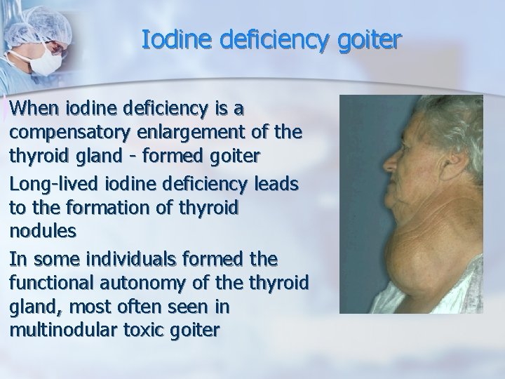 Iodine deficiency goiter When iodine deficiency is a compensatory enlargement of the thyroid gland Iodine deficiency goiter When iodine deficiency is a compensatory enlargement of the thyroid gland