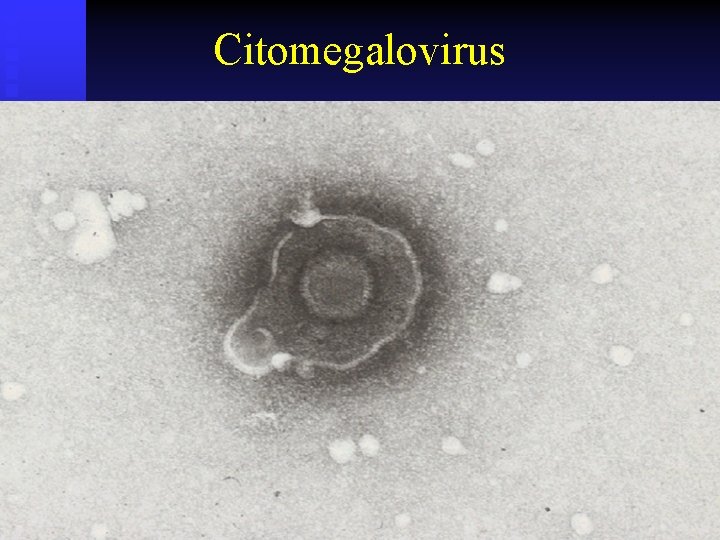 Citomegalovirus 