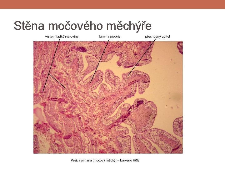 Stěna močového měchýře Stěna močového měchýře