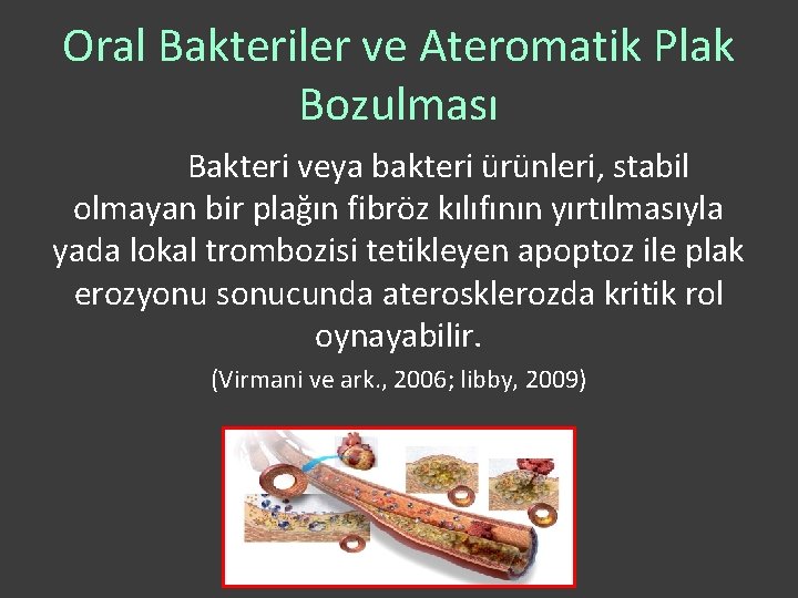 Oral Bakteriler ve Ateromatik Plak Bozulması Bakteri veya bakteri ürünleri, stabil olmayan bir plağın