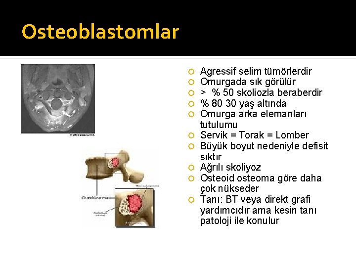 Osteoblastomlar Agressif selim tümörlerdir Omurgada sık görülür > % 50 skoliozla beraberdir % 80