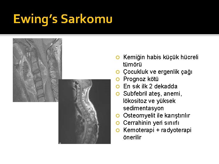 Ewing’s Sarkomu Kemiğin habis küçük hücreli tümörü Çocukluk ve ergenlik çağı Prognoz kötü En