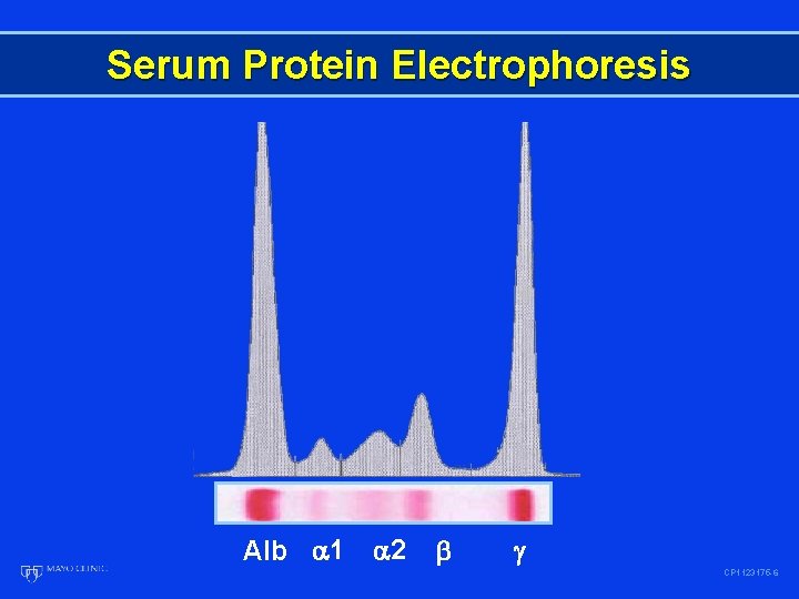 Serum Protein Electrophoresis Alb 1 2 CP 1123175 -6 