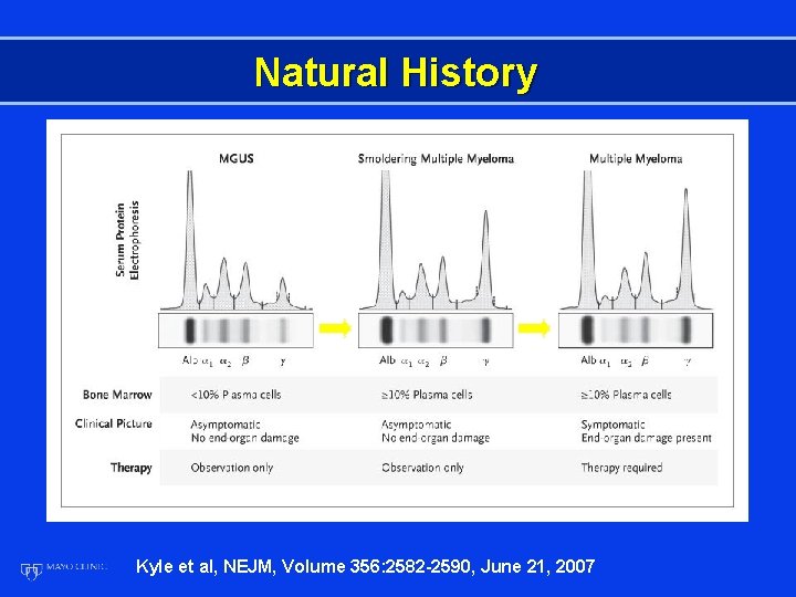 Natural History Kyle et al, NEJM, Volume 356: 2582 -2590, June 21, 2007 