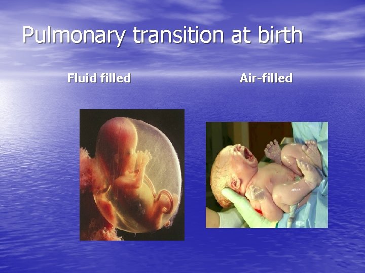 Pulmonary transition at birth Fluid filled Air-filled 