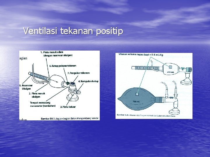 Ventilasi tekanan positip 