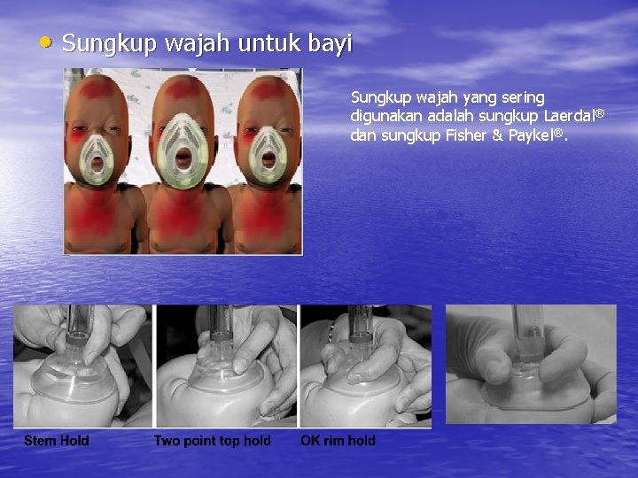  • Sungkup wajah untuk bayi Sungkup wajah yang sering digunakan adalah sungkup Laerdal®