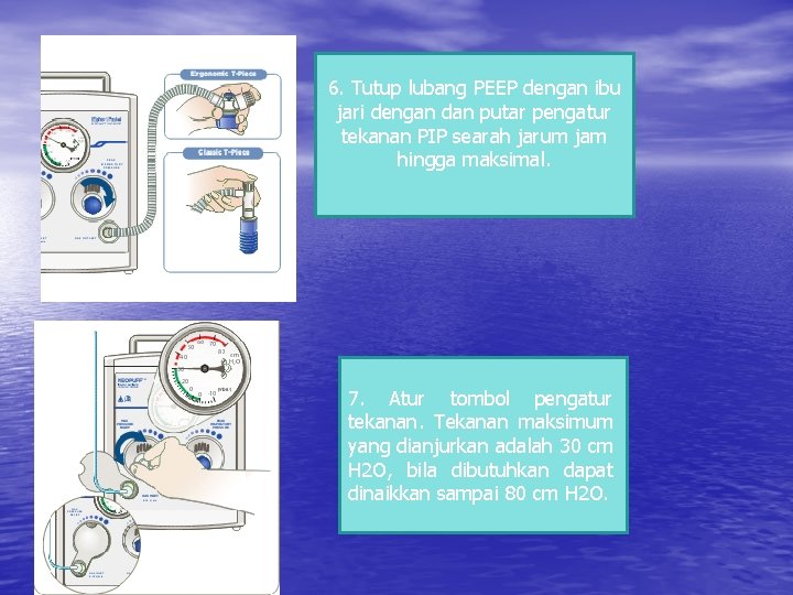  6. Tutup lubang PEEP dengan ibu jari dengan dan putar pengatur tekanan PIP