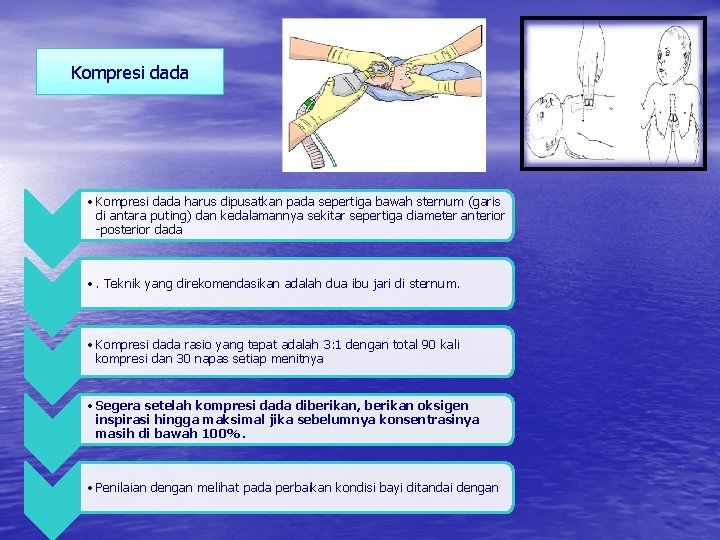 Kompresi dada • Kompresi dada harus dipusatkan pada sepertiga bawah sternum (garis di antara