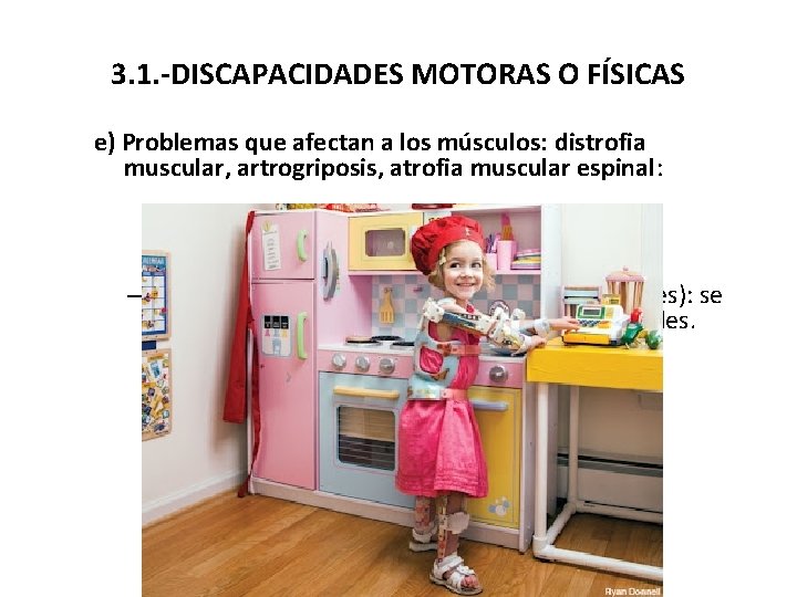 3. 1. -DISCAPACIDADES MOTORAS O FÍSICAS e) Problemas que afectan a los músculos: distrofia