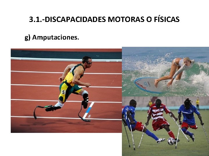3. 1. -DISCAPACIDADES MOTORAS O FÍSICAS g) Amputaciones. ¿Qué es? CARACTERÍSTICAS: Ausencia de extremidad,