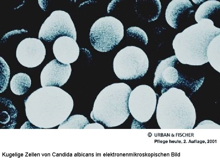 Kugelige Zellen von Candida albicans im elektronenmikroskopischen Bild 