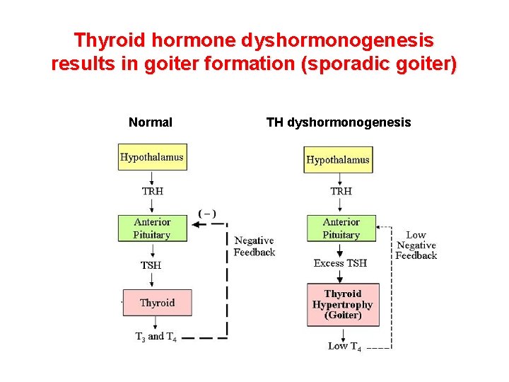 Thyroid hormone dyshormonogenesis results in goiter formation (sporadic goiter) Normal TH dyshormonogenesis Thyroid hormone dyshormonogenesis results in goiter formation (sporadic goiter) Normal TH dyshormonogenesis