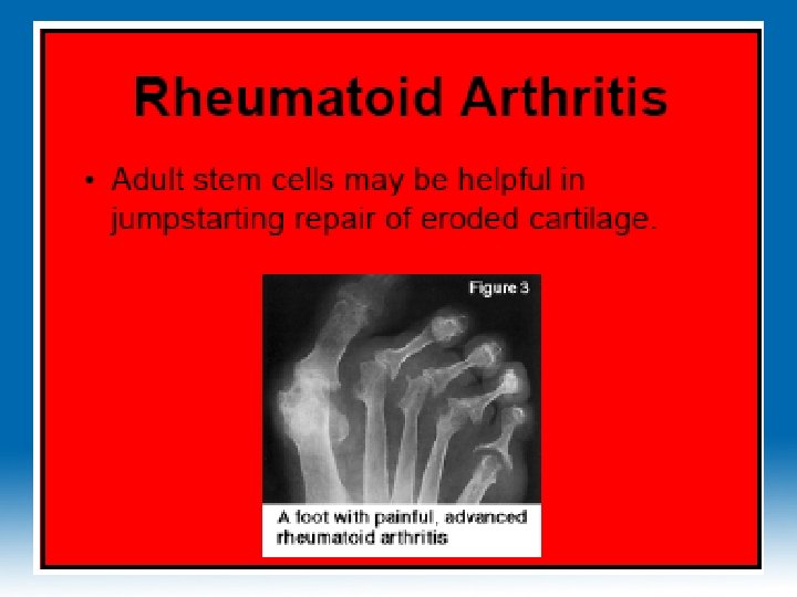 11/26/2020 Dr. Hariom Yadav 11/26/2020 Dr. Hariom Yadav