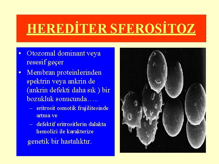 HEREDİTER SFEROSİTOZ • Otozomal dominant veya resesif geçer • Membran proteinlerinden spektrin veya ankrin