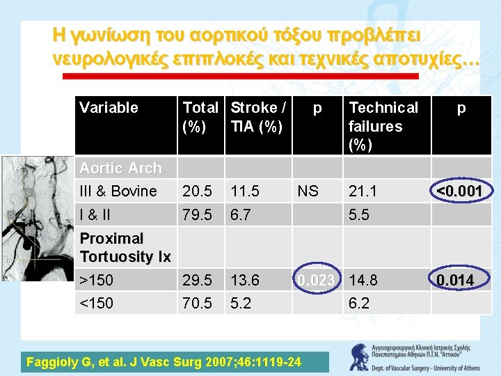 Η γωνίωση του αορτικού τόξου προβλέπει νευρολογικές επιπλοκές και τεχνικές αποτυχίες… Variable Total Stroke