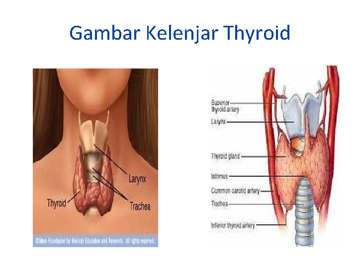 Gambar Kelenjar Thyroid 