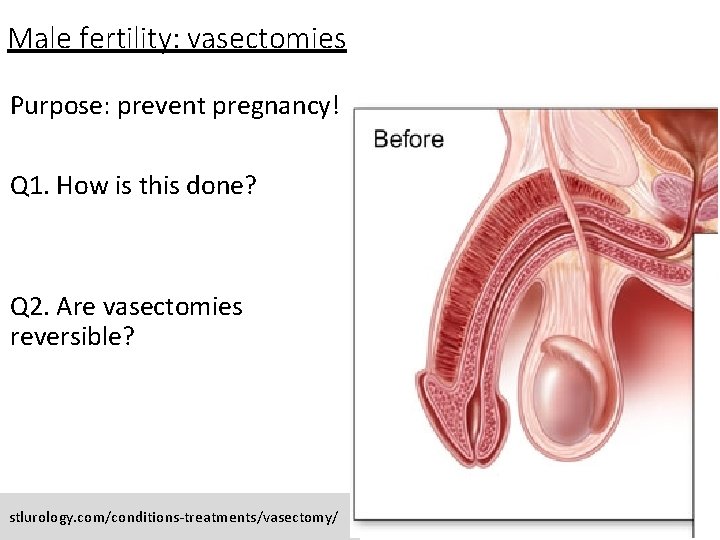 Male fertility: vasectomies Purpose: prevent pregnancy! Q 1. How is this done? Q 2.