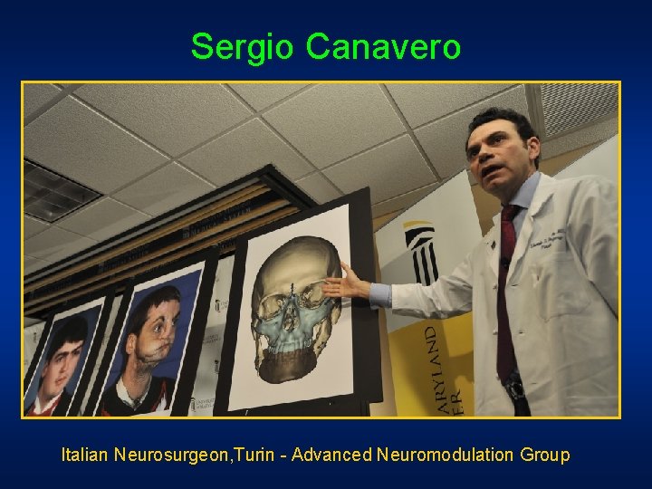 Sergio Canavero Italian Neurosurgeon, Turin - Advanced Neuromodulation Group Sergio Canavero Italian Neurosurgeon, Turin - Advanced Neuromodulation Group