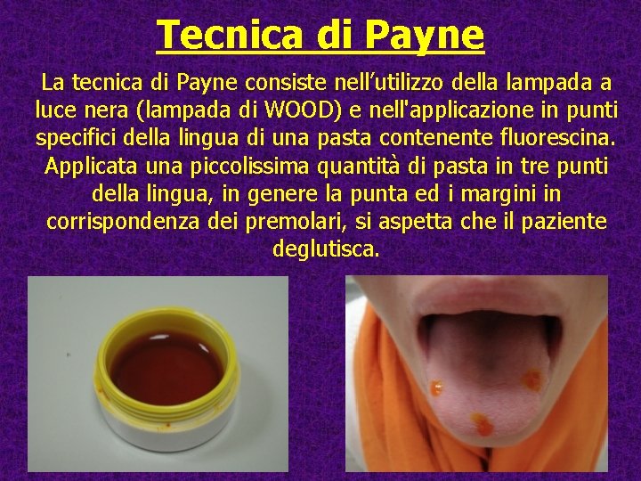 Tecnica di Payne La tecnica di Payne consiste nell’utilizzo della lampada a luce nera Tecnica di Payne La tecnica di Payne consiste nell’utilizzo della lampada a luce nera