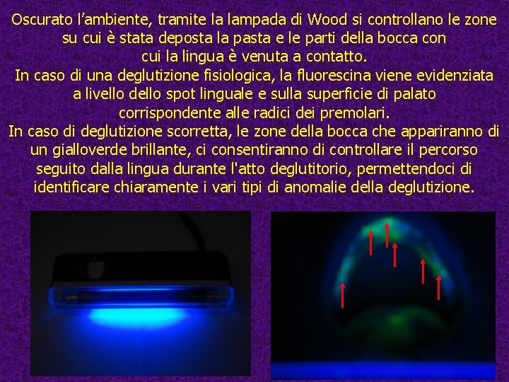 Oscurato l’ambiente, tramite la lampada di Wood si controllano le zone su cui è Oscurato l’ambiente, tramite la lampada di Wood si controllano le zone su cui è