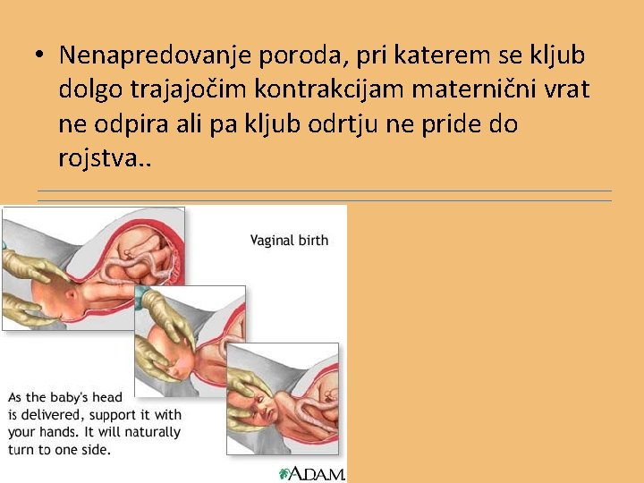  • Nenapredovanje poroda, pri katerem se kljub dolgo trajajočim kontrakcijam maternični vrat ne