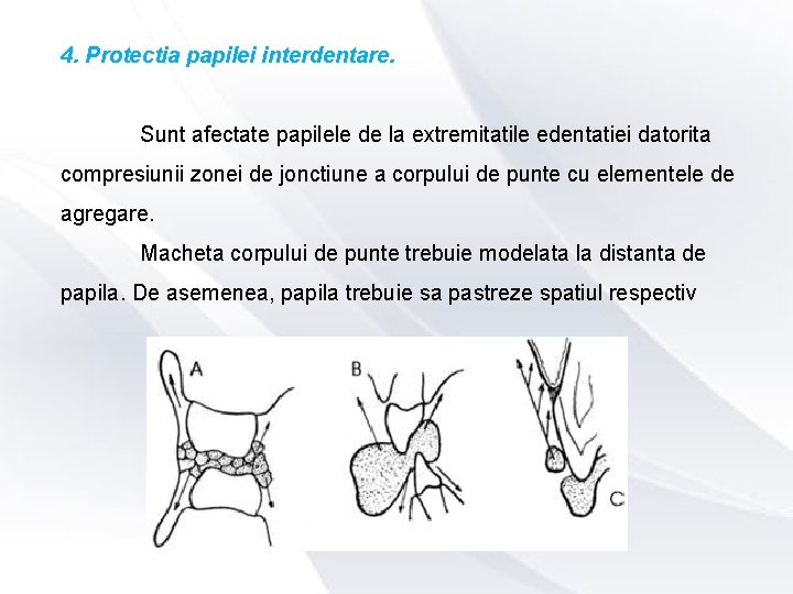 4. Protectia papilei interdentare. Sunt afectate papilele de la extremitatile edentatiei datorita compresiunii zonei