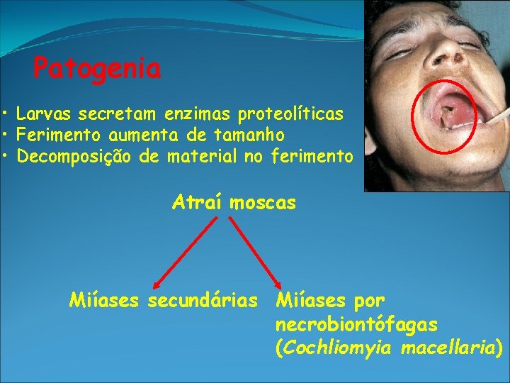 Patogenia • Larvas secretam enzimas proteolíticas • Ferimento aumenta de tamanho • Decomposição de