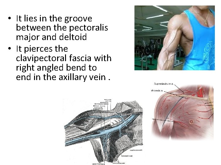  • It lies in the groove between the pectoralis major and deltoid •