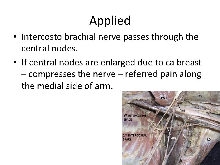 Applied • Intercosto brachial nerve passes through the central nodes. • If central nodes