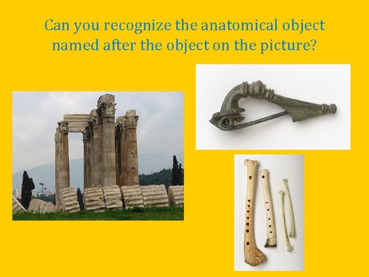 Can you recognize the anatomical object named after the object on the picture? 
