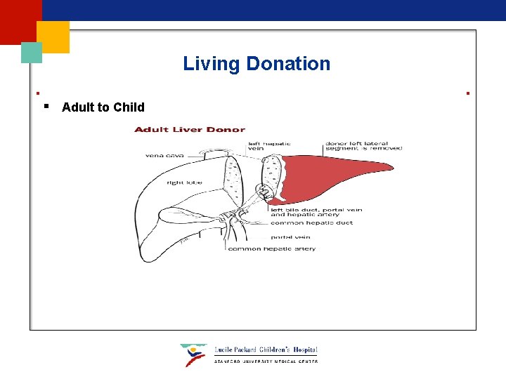 Living Donation § Adult to Child Living Donation § Adult to Child