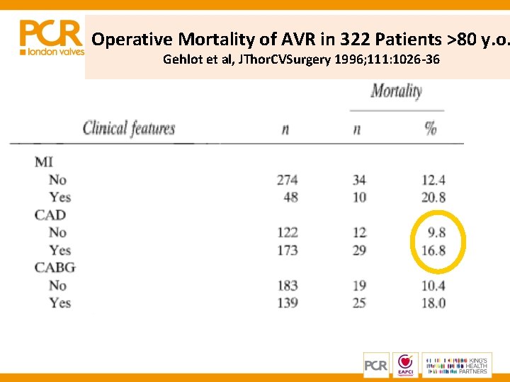 Operative Mortality of AVR in 322 Patients >80 y. o. Gehlot et al, JThor. Operative Mortality of AVR in 322 Patients >80 y. o. Gehlot et al, JThor.