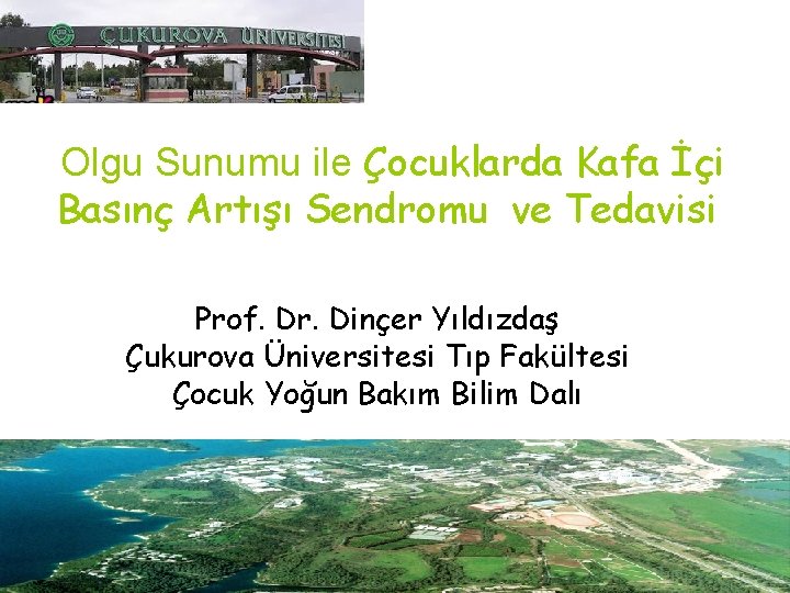 Olgu Sunumu ile Çocuklarda Kafa İçi Basınç Artışı Sendromu ve Tedavisi Prof. Dr. Dinçer