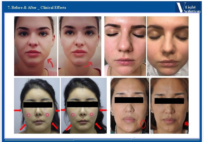 7. Before & After _ Clinical Effects 