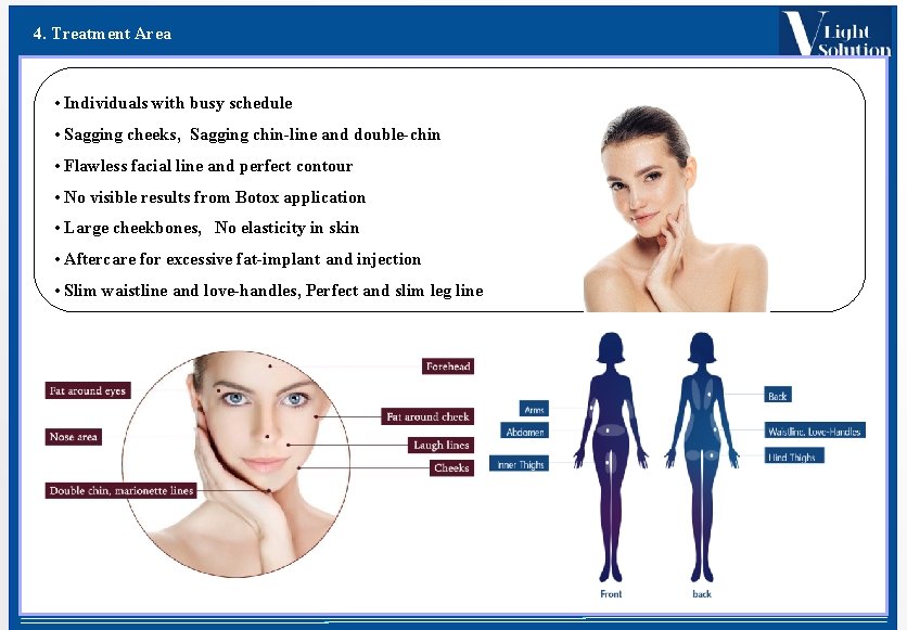 4. Treatment Area • Individuals with busy schedule • Sagging cheeks, Sagging chin-line and