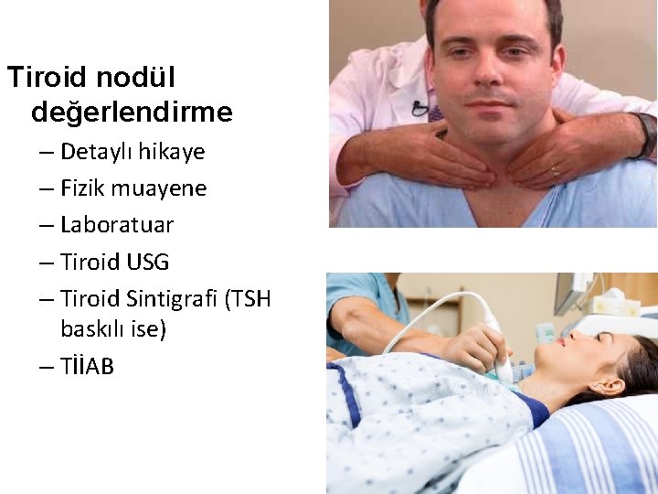 Tiroid nodül değerlendirme – Detaylı hikaye – Fizik muayene – Laboratuar – Tiroid USG