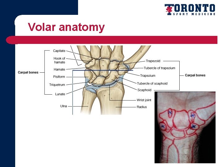 Volar anatomy 