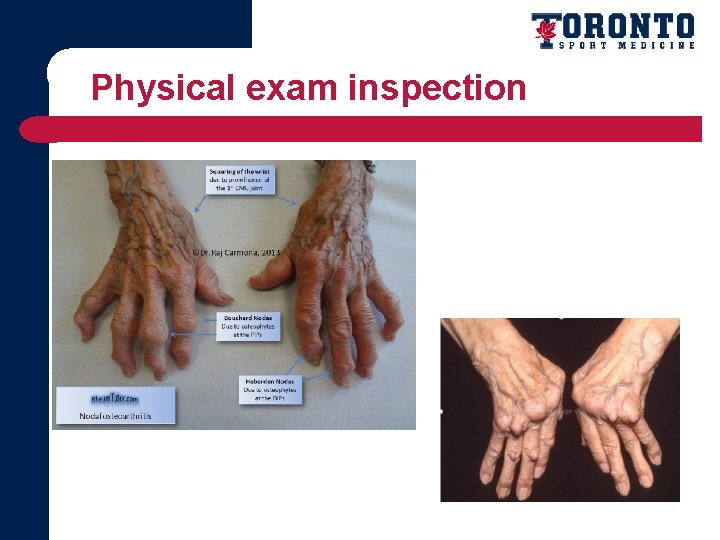 Physical exam inspection 