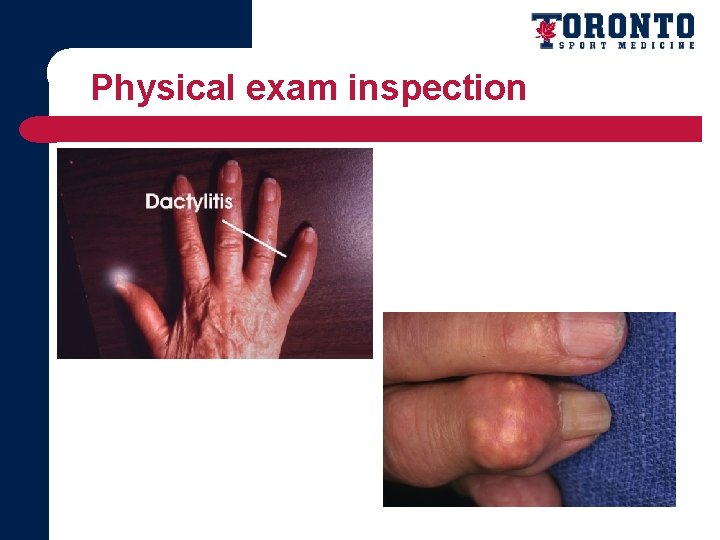 Physical exam inspection 