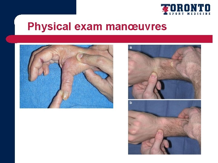 Physical exam manœuvres 