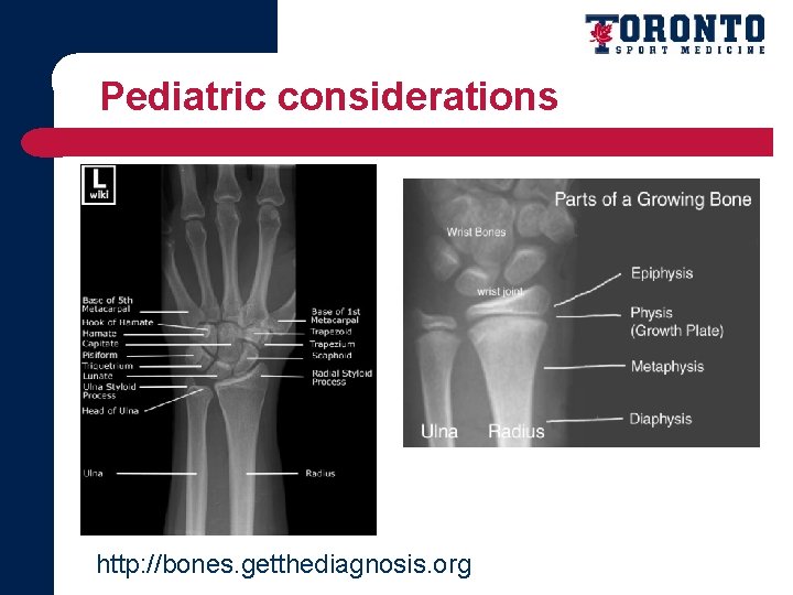 Pediatric considerations http: //bones. getthediagnosis. org 