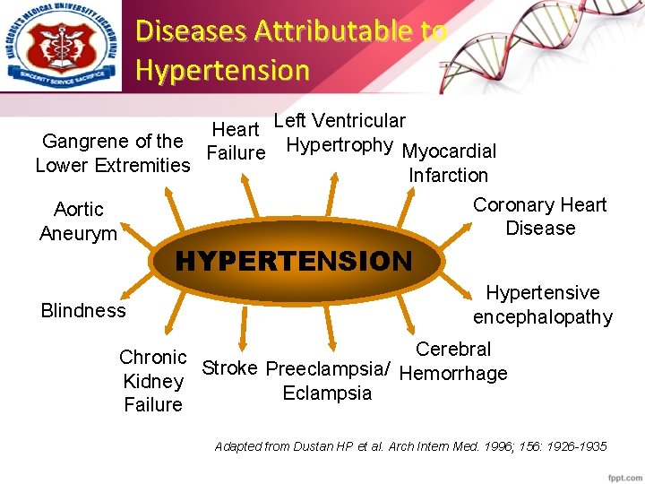 Diseases Attributable to Hypertension Heart Left Ventricular Gangrene of the Failure Hypertrophy Myocardial Lower