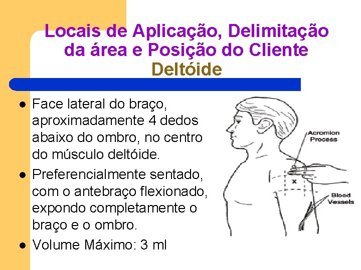 Locais de Aplicação, Delimitação da área e Posição do Cliente Deltóide l l l Locais de Aplicação, Delimitação da área e Posição do Cliente Deltóide l l l