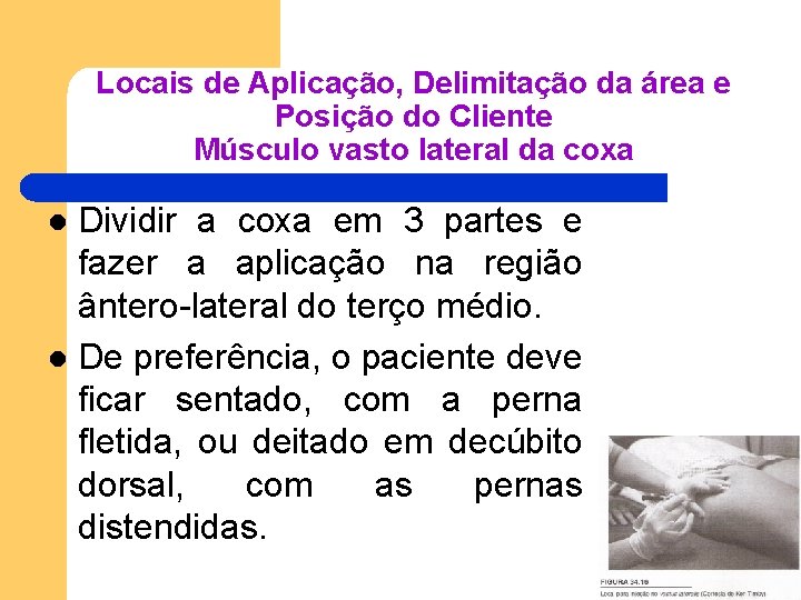 Locais de Aplicação, Delimitação da área e Posição do Cliente Músculo vasto lateral da Locais de Aplicação, Delimitação da área e Posição do Cliente Músculo vasto lateral da