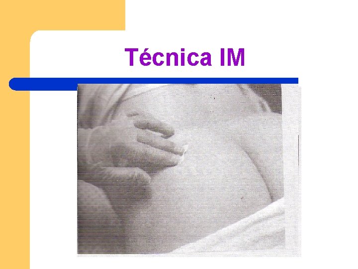 Técnica IM Técnica IM