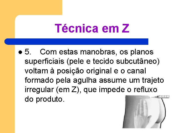Técnica em Z l 5. Com estas manobras, os planos superficiais (pele e tecido Técnica em Z l 5. Com estas manobras, os planos superficiais (pele e tecido