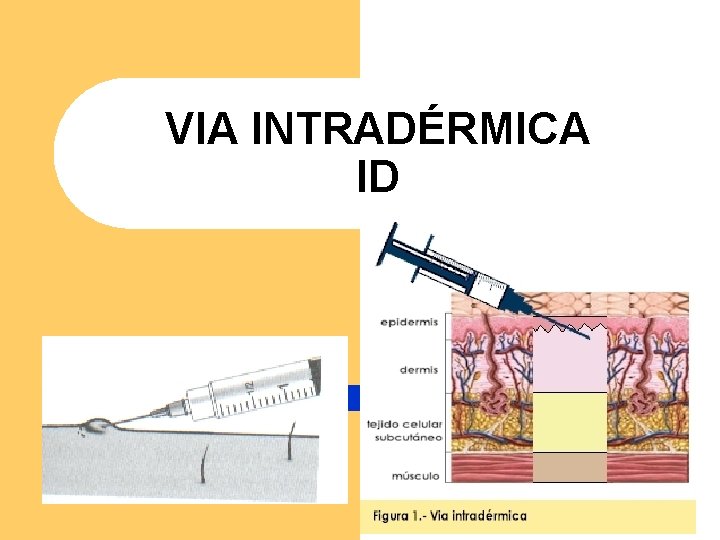 VIA INTRADÉRMICA ID VIA INTRADÉRMICA ID